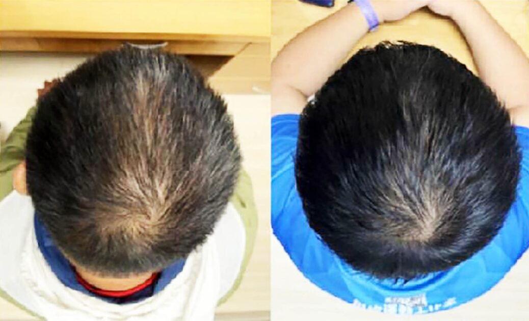 Natural remedies for hair growth and thickness using amla, bhringraj, curry leaves and fenugreek